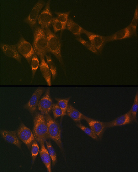 ACADM Antibody in Immunocytochemistry (ICC/IF)