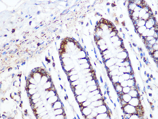 ACADM Antibody in Immunohistochemistry (Paraffin) (IHC (P))