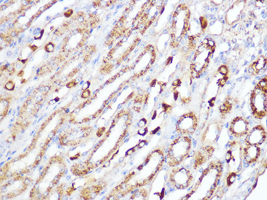 ACADM Antibody in Immunohistochemistry (Paraffin) (IHC (P))