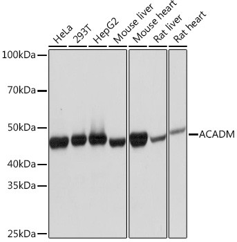 ACADM Antibody in Western Blot (WB)