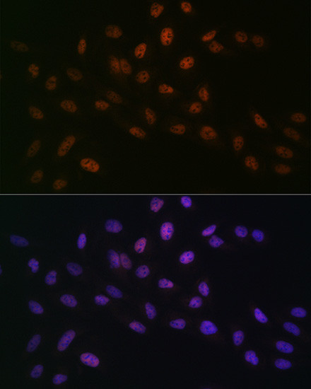 MTA2 Antibody in Immunocytochemistry (ICC/IF)