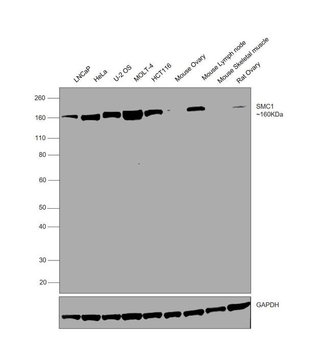 SMC1 Antibody in Western Blot (WB)