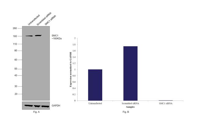 SMC1 Antibody in Western Blot (WB)