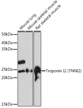 TNNI2 Antibody in Western Blot (WB)