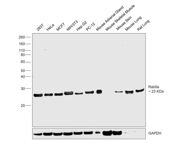 RAB9 Antibody in Western Blot (WB)