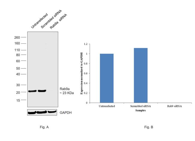 RAB9 Antibody in Western Blot (WB)