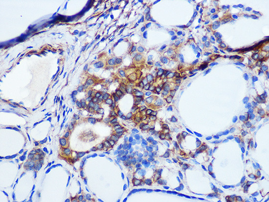 Pan-cadherin Antibody in Immunohistochemistry (Paraffin) (IHC (P))