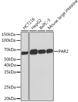 PAR2 Antibody in Western Blot (WB)