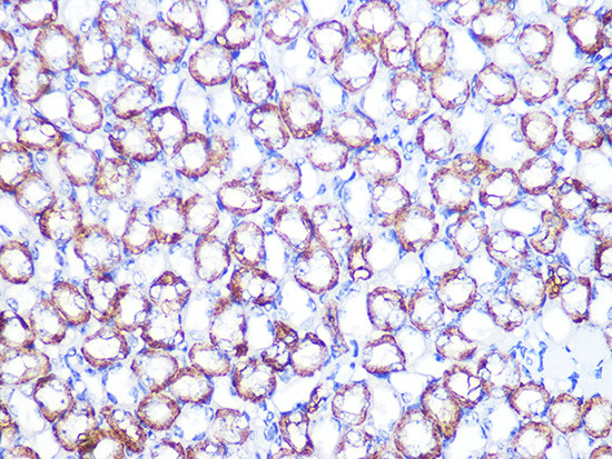 ATP1B1 Antibody in Immunohistochemistry (Paraffin) (IHC (P))