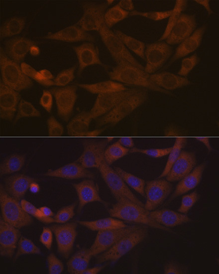 Desmoglein 3 Antibody in Immunocytochemistry (ICC/IF)