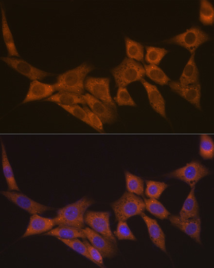 DCP1A Antibody in Immunocytochemistry (ICC/IF)