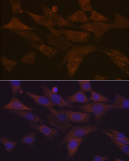 PKC delta Antibody in Immunocytochemistry (ICC/IF)