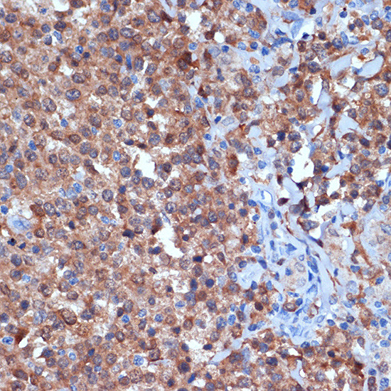 PKC delta Antibody in Immunohistochemistry (Paraffin) (IHC (P))