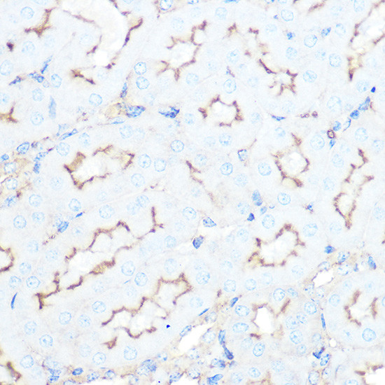 SSTR5 Antibody in Immunohistochemistry (Paraffin) (IHC (P))