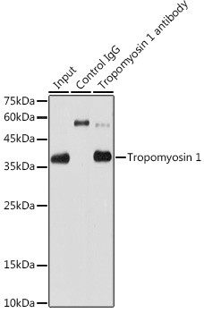 TPM1 Antibody in Immunoprecipitation (IP)