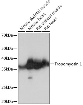 TPM1 Antibody in Western Blot (WB)