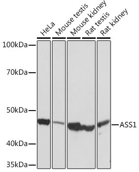 ASS1 Antibody in Western Blot (WB)