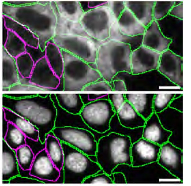 CaMKII delta Antibody in Immunocytochemistry (ICC/IF)