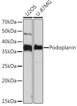 Podoplanin Antibody in Western Blot (WB)