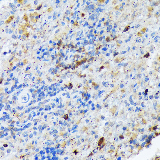 CARD11 Antibody in Immunohistochemistry (Paraffin) (IHC (P))