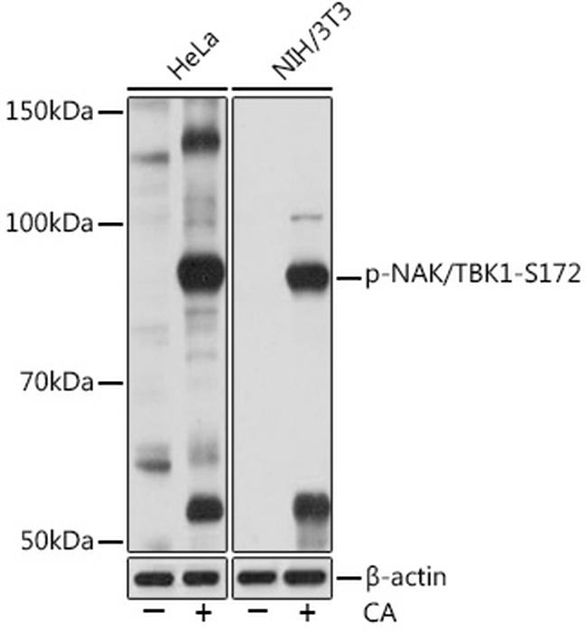 Phospho-TBK1 (Ser172) Antibody in Western Blot (WB)