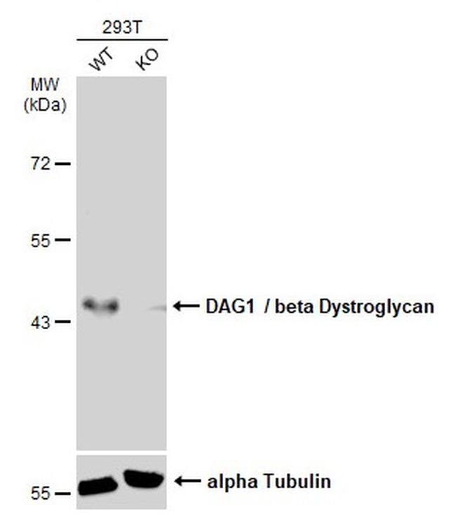 beta Dystroglycan Antibody in Western Blot (WB)