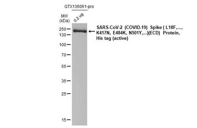 SARS/SARS-CoV-2 Spike Protein S2 Antibody in Western Blot (WB)