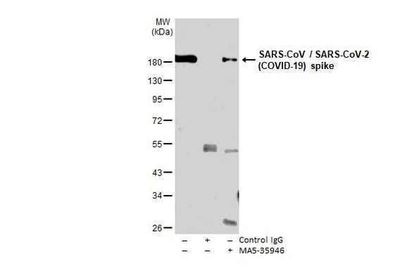 SARS/SARS-CoV-2 Spike Protein S2 Monoclonal Antibody (1A9) (MA5-35946)