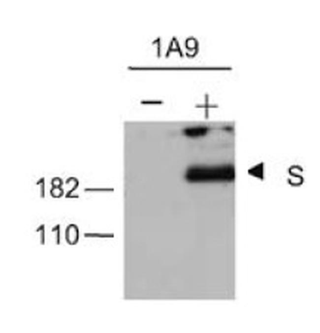 SARS/SARS-CoV-2 Spike Protein S2 Antibody in Western Blot (WB)