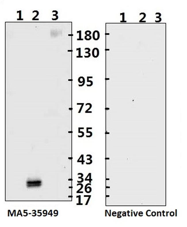 SARS-CoV-2 Spike Protein (S1/S2) Antibody in Western Blot (WB)