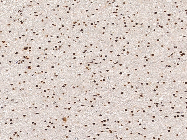 p38 MAPK alpha Antibody in Immunohistochemistry (Paraffin) (IHC (P))