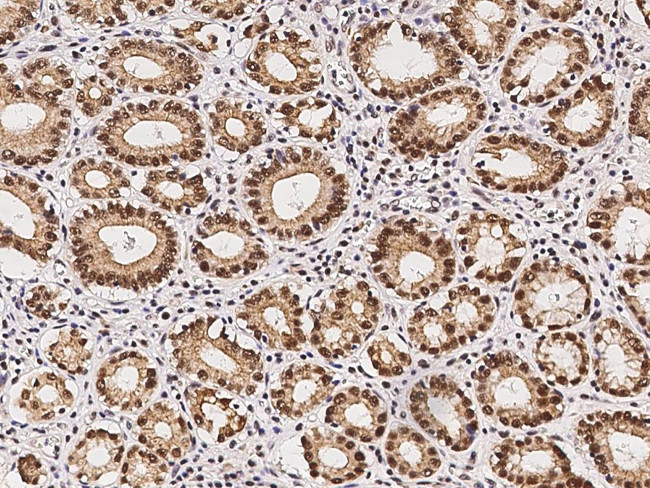 p38 MAPK alpha Antibody in Immunohistochemistry (Paraffin) (IHC (P))