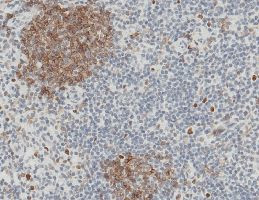 CD32b Antibody in Immunohistochemistry (Paraffin) (IHC (P))