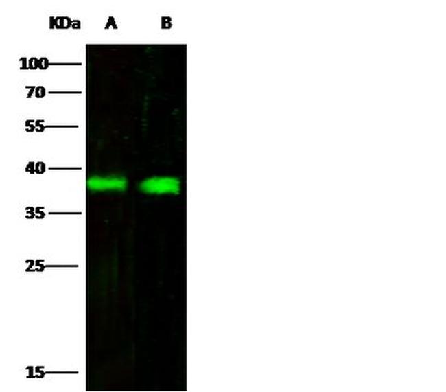 CD32b Antibody in Western Blot (WB)