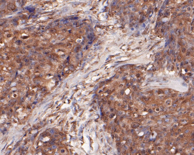 DFNA5 Antibody in Immunohistochemistry (Paraffin) (IHC (P))