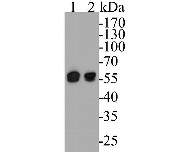 DFNA5 Antibody in Western Blot (WB)