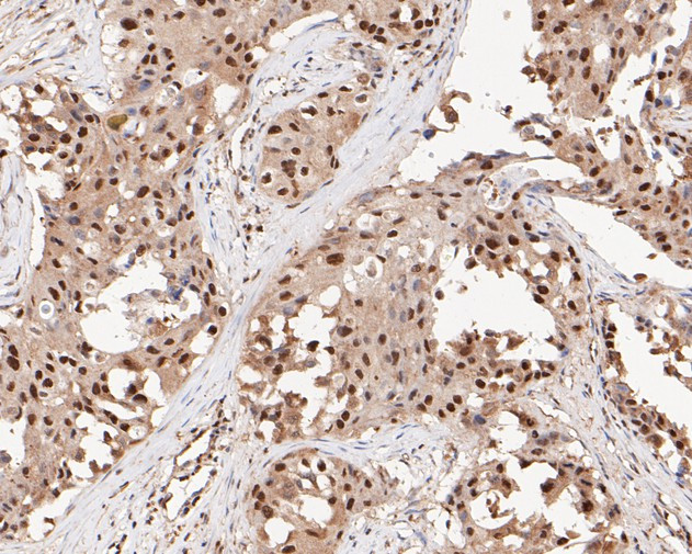 MTA2 Antibody in Immunohistochemistry (Paraffin) (IHC (P))