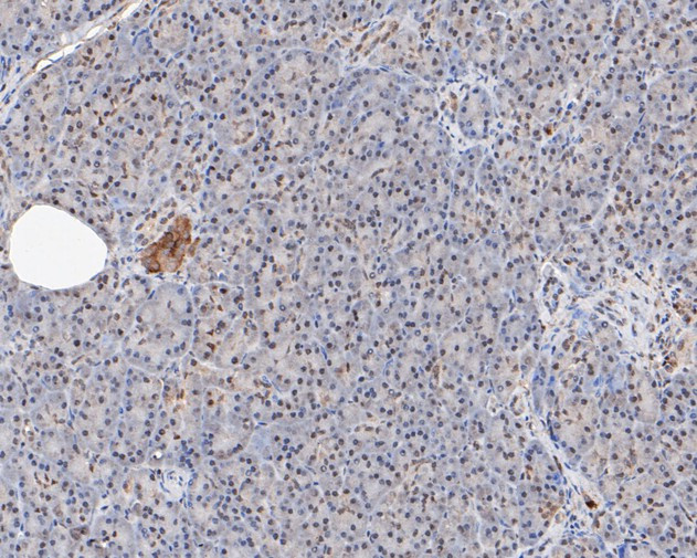 MTA2 Antibody in Immunohistochemistry (Paraffin) (IHC (P))