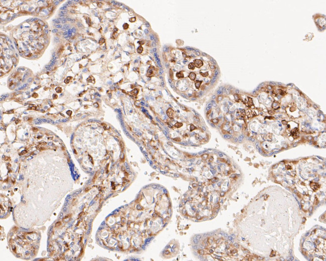 NFKB2 Antibody in Immunohistochemistry (Paraffin) (IHC (P))