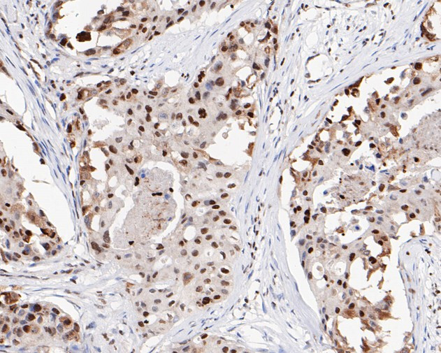 HMGB2 Antibody in Immunohistochemistry (Paraffin) (IHC (P))