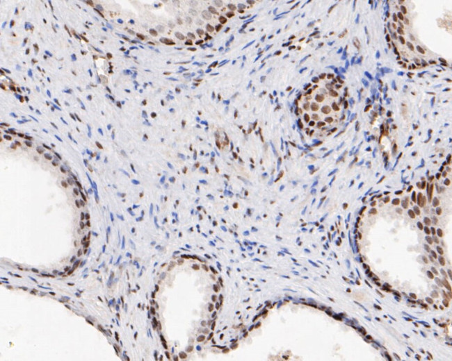 HMGB2 Antibody in Immunohistochemistry (Paraffin) (IHC (P))