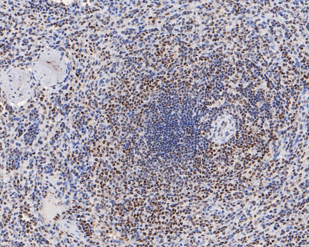 HMGB2 Antibody in Immunohistochemistry (Paraffin) (IHC (P))