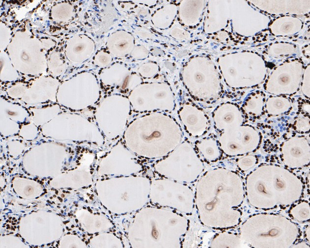 HMGB2 Antibody in Immunohistochemistry (Paraffin) (IHC (P))