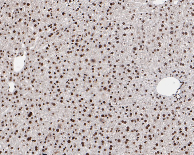 HMGB2 Antibody in Immunohistochemistry (Paraffin) (IHC (P))