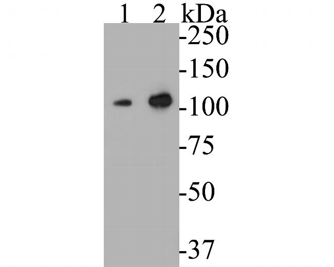 CASK Antibody in Western Blot (WB)