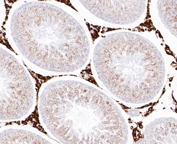 NRG3 Antibody in Immunohistochemistry (Paraffin) (IHC (P))