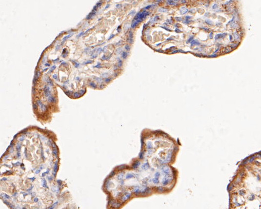 Phospho-ErbB3 (Tyr1222) Antibody in Immunohistochemistry (Paraffin) (IHC (P))