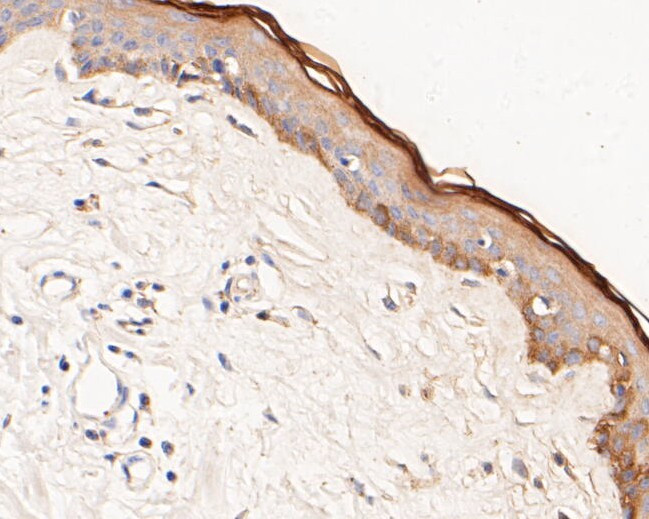 Phospho-ErbB3 (Tyr1222) Antibody in Immunohistochemistry (Paraffin) (IHC (P))