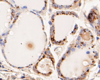 Phospho-ErbB3 (Tyr1222) Antibody in Immunohistochemistry (Paraffin) (IHC (P))