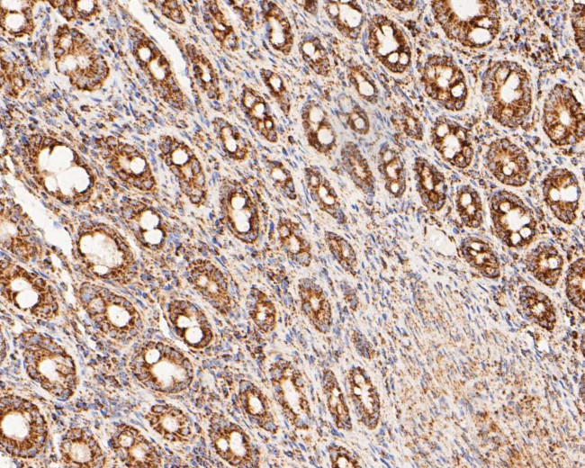 LDHD Antibody in Immunohistochemistry (Paraffin) (IHC (P))